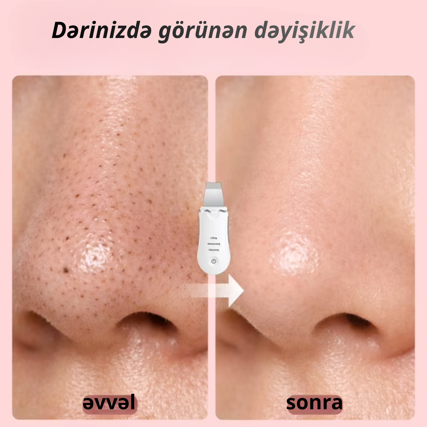 Ultrasəs Üz Təmizləmə Cihazı