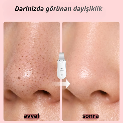 Ultrasəs Üz Təmizləmə Cihazı